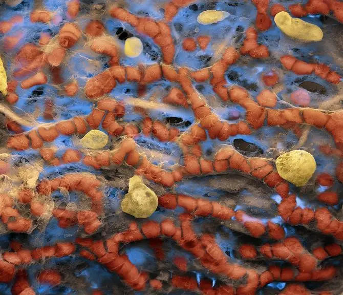 A close up of some orange and yellow worms